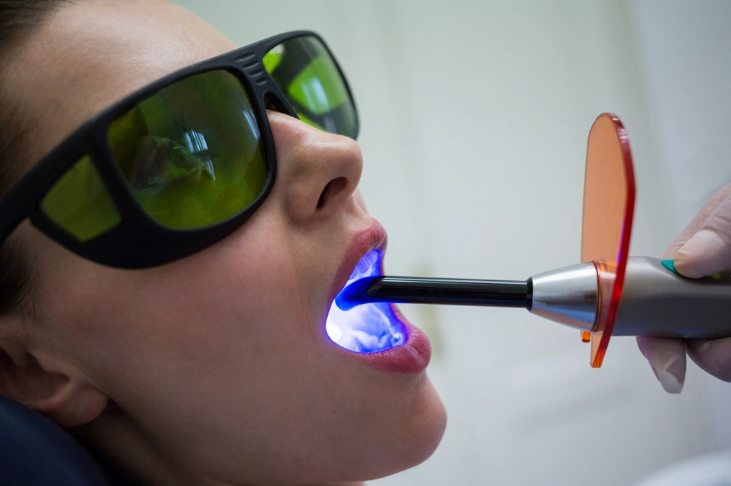 Dental Lasers: Insurance Issues Cover Image
